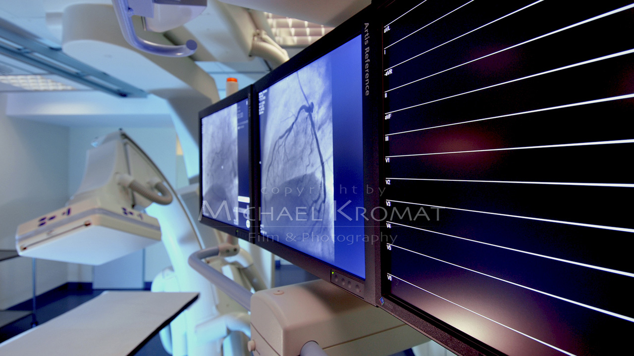 Coronarangiographie